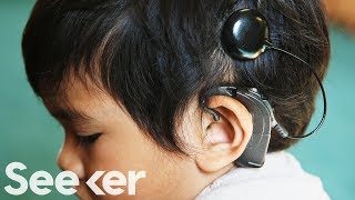 How Do Cochlear Implants Work [upl. by Abott195]