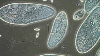 Paramecia Contractile Vacuoles by Edwin Lee [upl. by Ayikaz484]