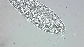 paramecium contractile vacuole [upl. by Dhruv]