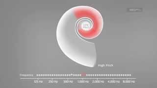 Cochlea Implantat Hörbeispiel  Simulator Cochlea Implantat [upl. by Scharff85]